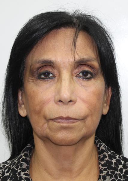 AURISTELA ANA OBANDO MORGAN
