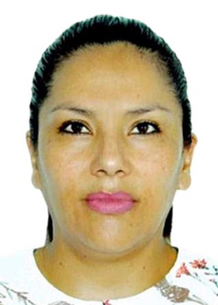 DIGNA CALLE LOBATON