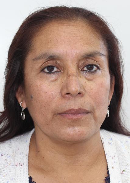 Alicia tananta tenazoa
