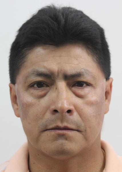 Jorge Luis Escalante Soplin