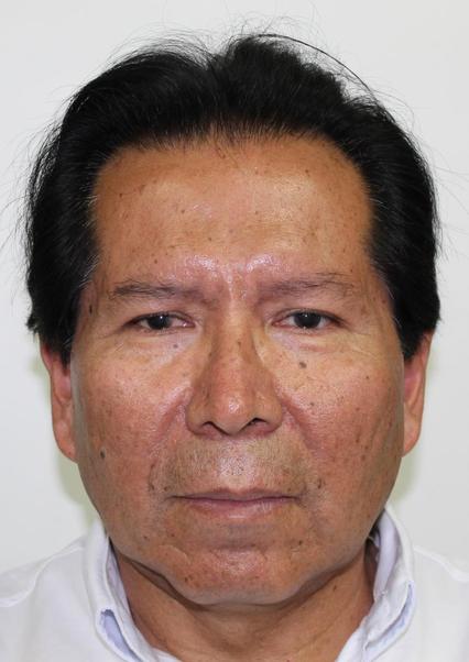 Luis Vidal Peralta Claros