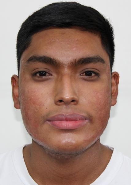 Miguel Ramirez Yupton