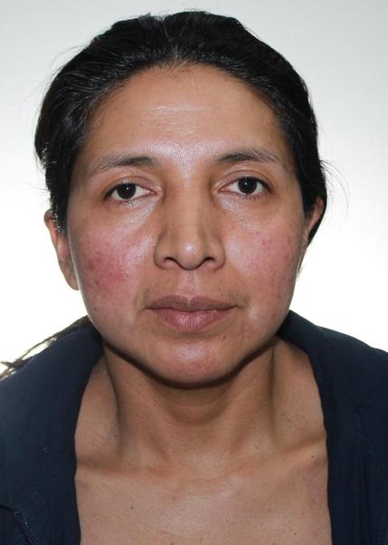 Nelida pallara huaÑac