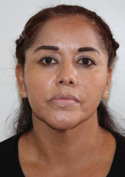 Norma Diaz Medina