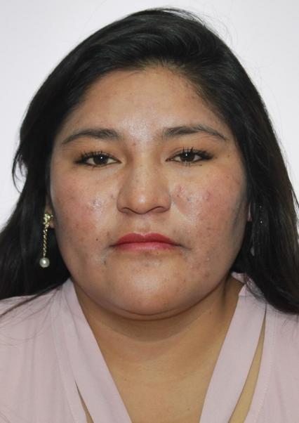 Reyna Soledad Suma Uscca