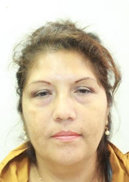 Vilma rosario gonzales dolores