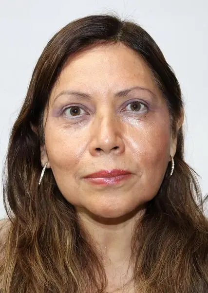 DORA GIANINA