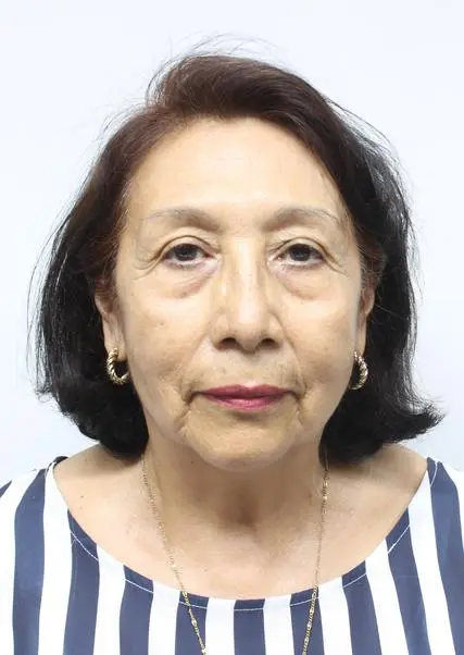 CLOTILDE