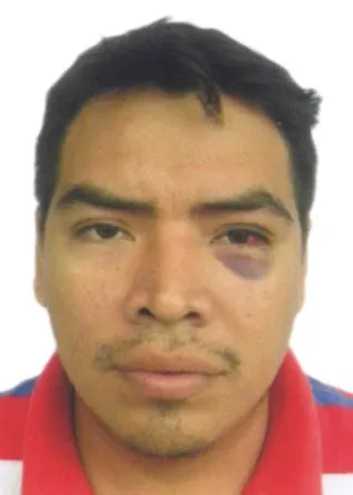 OSCAR LUIS