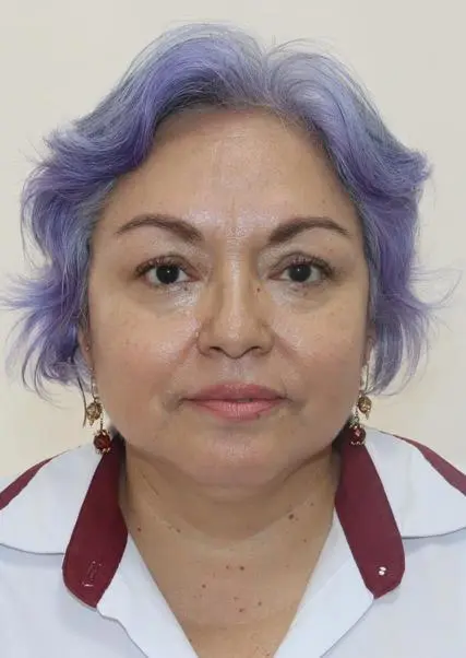 ESTHER