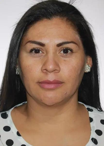 ATSARA LINDA